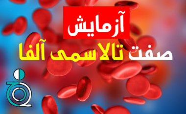 آزمایش صفت تالاسمی آلفا