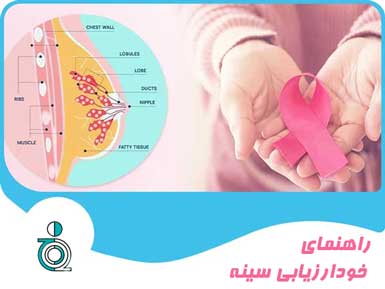 راهنمای خودارزیابی سینه
