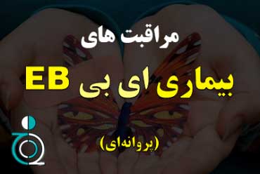 مراقبت های بیماری EB