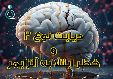 دیابت نوع ۲ و خطر ابتلا به آلزایمر