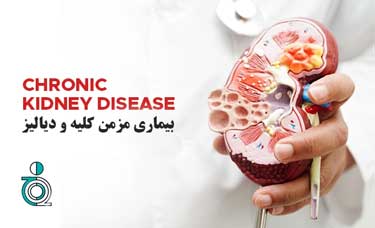 بیماری مزمن کلیه و دیالیز